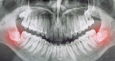 Woman brushing teeth in Guilderland