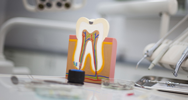 Model of tooth and gum tissue