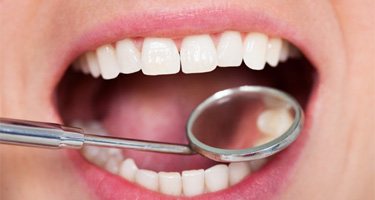 dental mirror in a patient’s mouth  