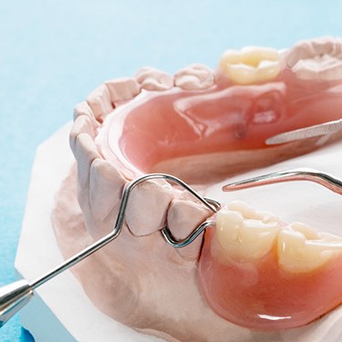 partial dentures sitting atop a plaster mold