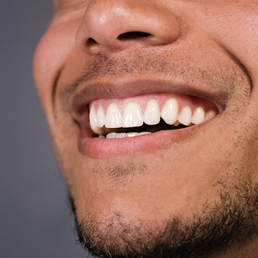 Close-up of man with gummy smile