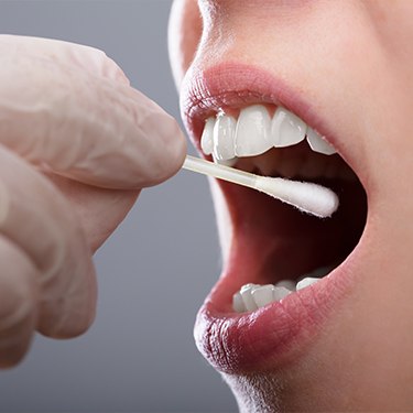 Dentist conducting a salivary test