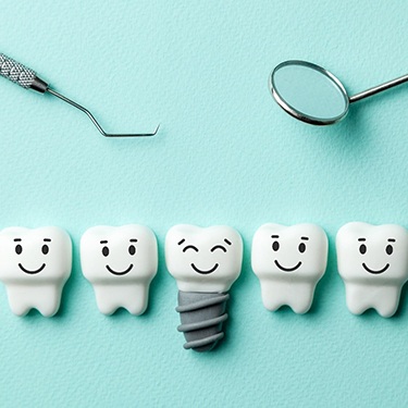  Illustration of dental implants in Schenectady