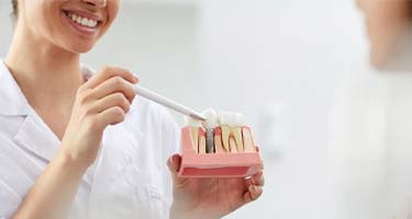 dentist showing a patient how dental implants work in Guilderland