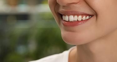 Nose-to-shoulder view of someone with overbite and slight gap smiling