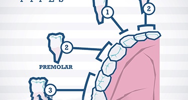 illustration for types of teeth 