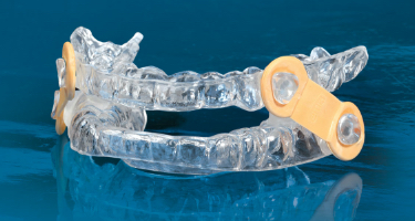 Elastic mandibular advancement sleep apnea appliance