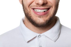 Man with missing tooth, needs tooth replacement