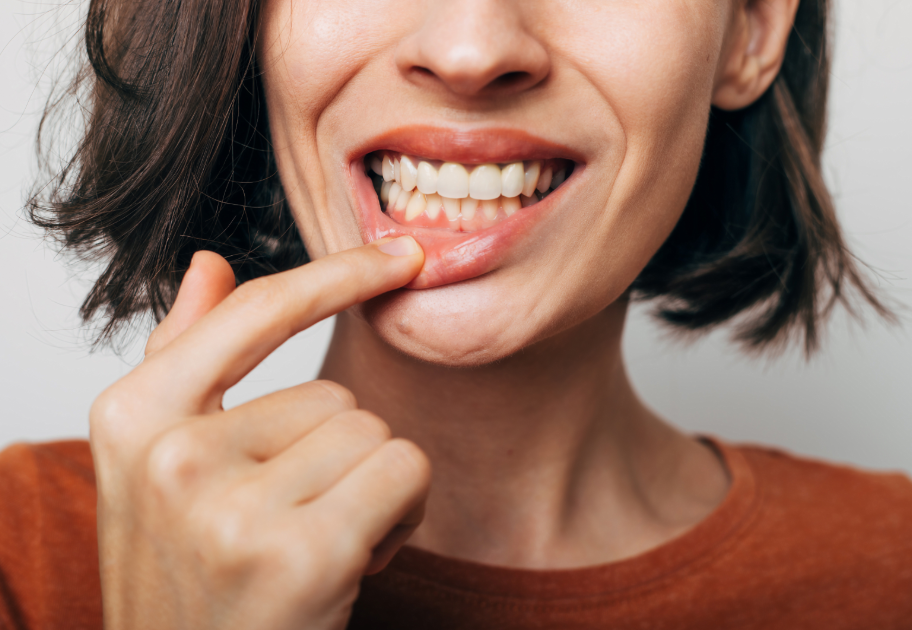 Woman pulling lip down to show gums